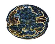 07_Anterior